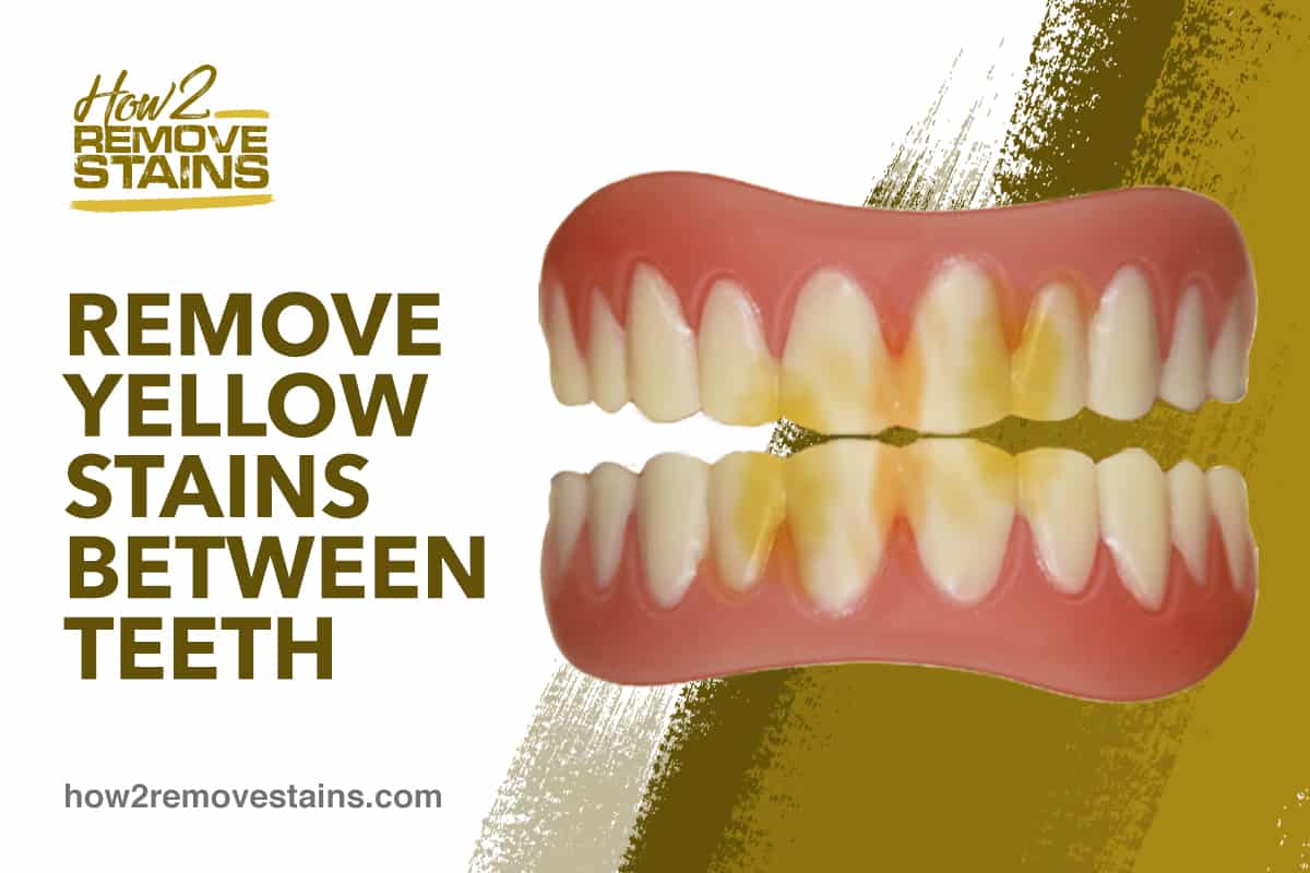 Wie man gelbe Flecken zwischen den Zähnen entfernt