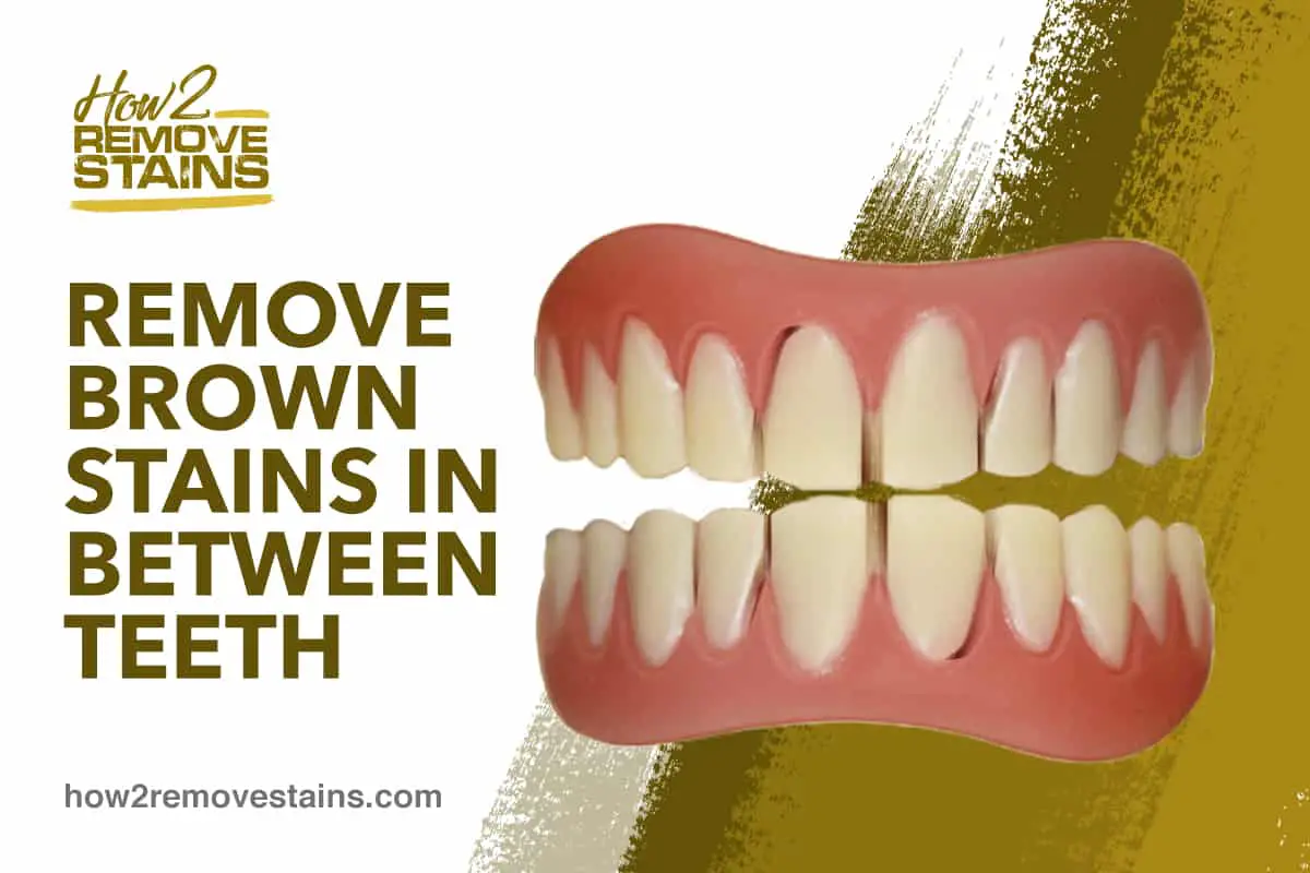 Wie man braune Flecken in den Zahnzwischenräumen entfernt